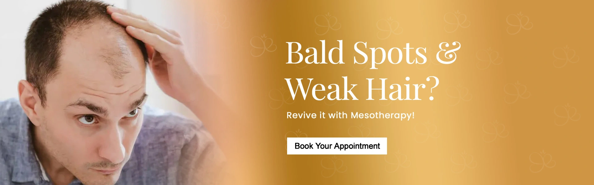 mesotherapy-service.webp