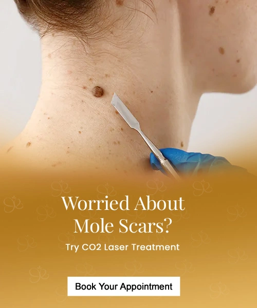 mole-removal-service-mobile.webp