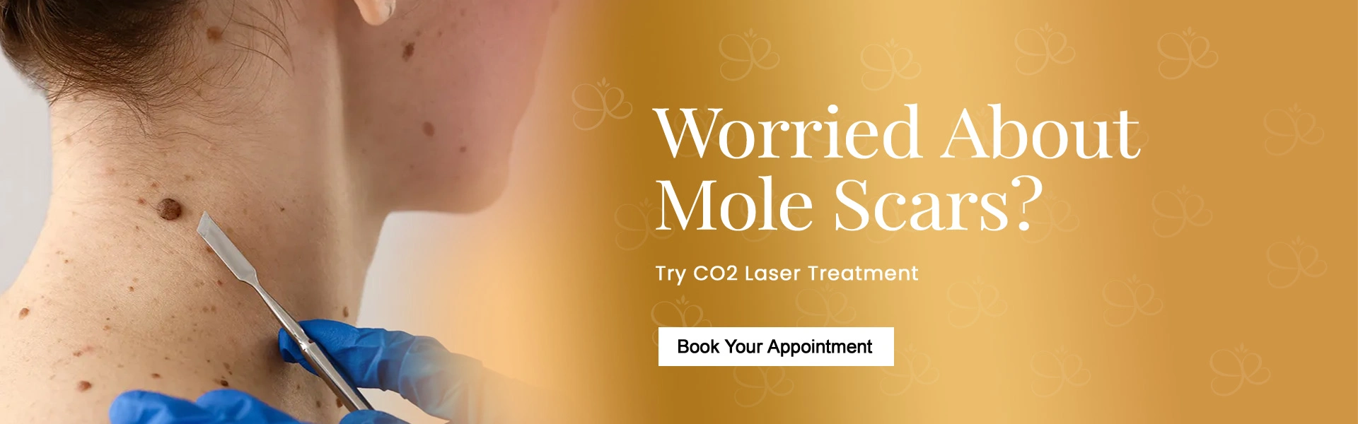 mole-removal-service.webp